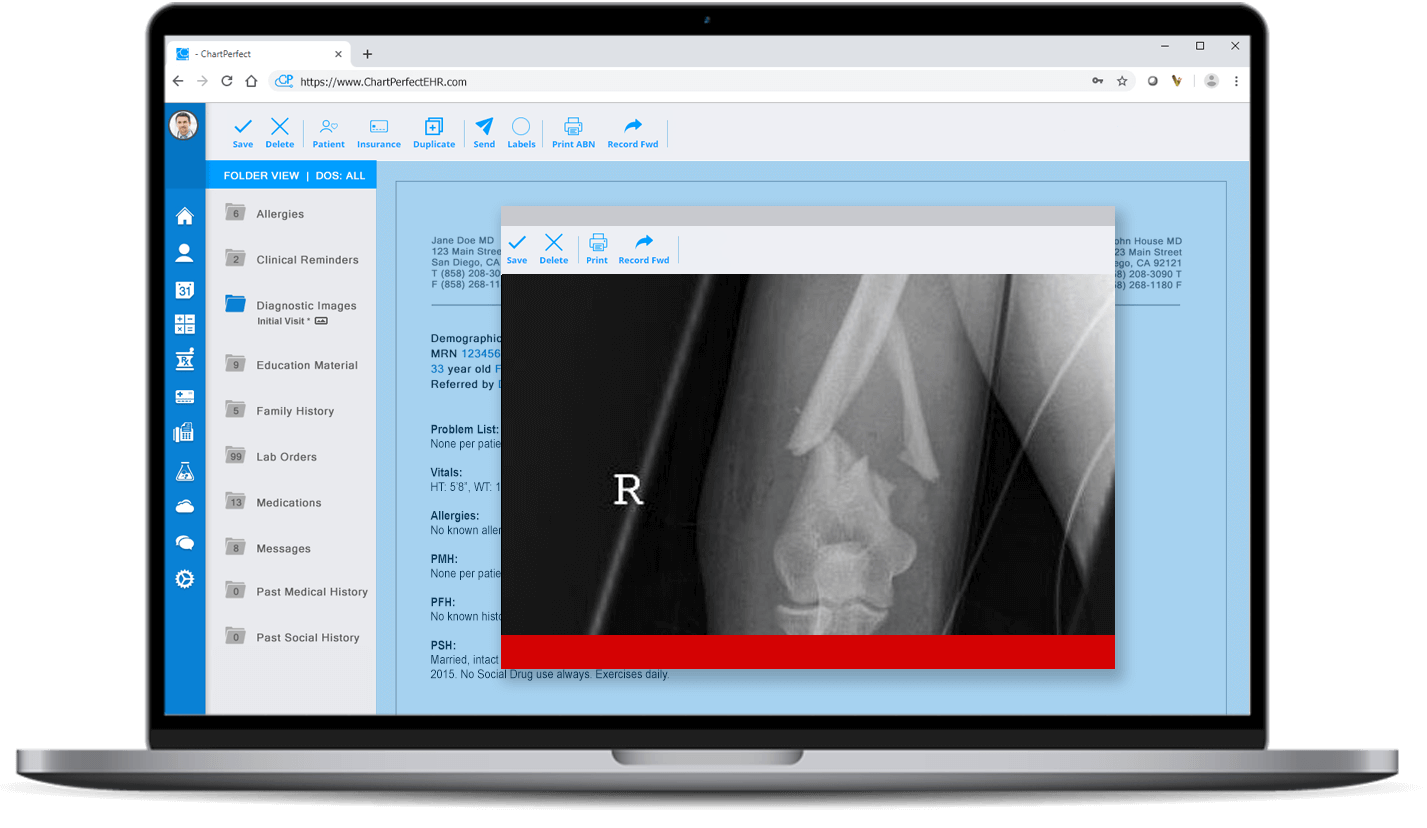ChartPerfect EHR HL7 interface device connectivity for orthopedic practices