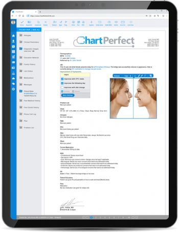 EHR and Practice Management Platform for Plastic Surgery | ChartPerfect